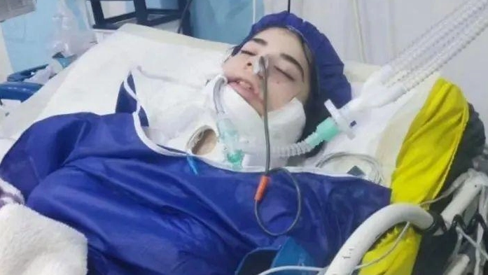 Pestata in Iran perché non indossava il velo. A 16 anni in coma, una nuova Mahsa Amini