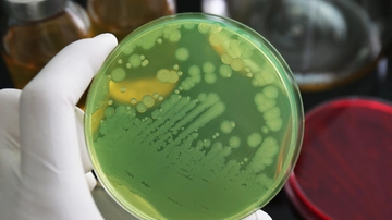 Pseudomonas aeruginosa: allarme dagli Usa per il super batterio che colpisce gli occhi. Cosa sappiamo