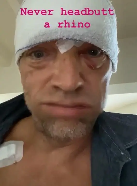 Vincent Cassel, incidente in moto. "Mai dare una testata a un rinoceronte"