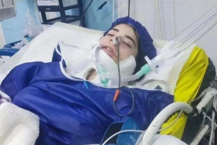 Pestata in Iran perché non indossava il velo. A 16 anni in coma, una nuova Mahsa Amini