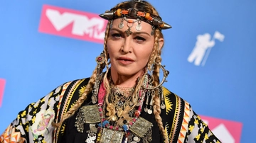 Madonna e il malore, “ecco che cosa lo ha provocato”. Come sta oggi la pop star?