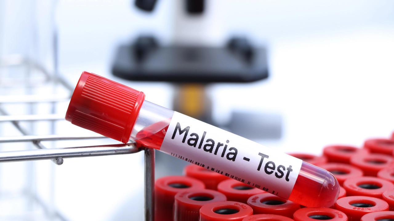 Malaria test to look for abnormalities from blood, blood sample to analyze in the laboratory, blood in test tube