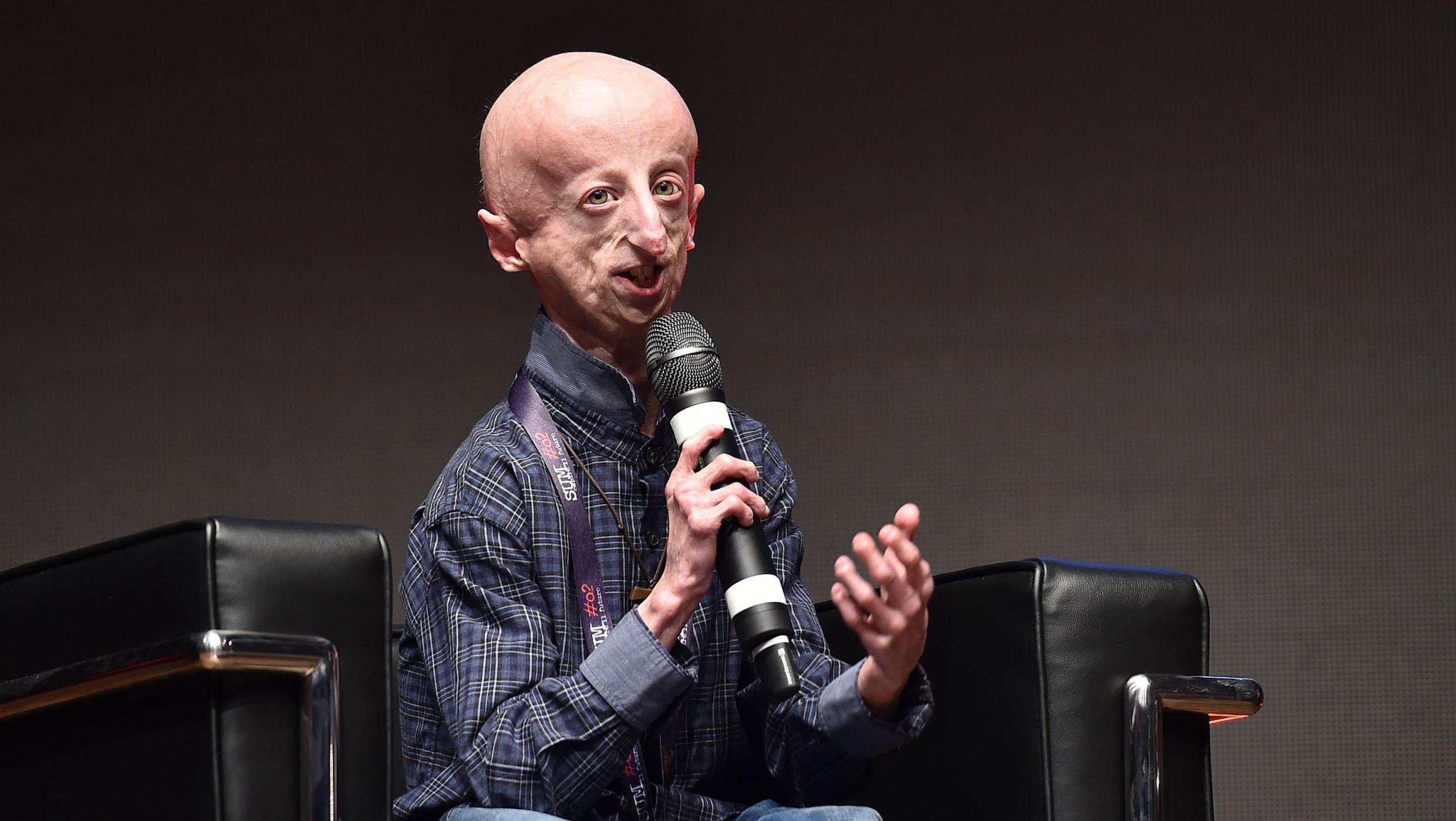 Cos’è la progeria di Hutchinson Gilford, la malattia da cui era affetto Sammy Basso