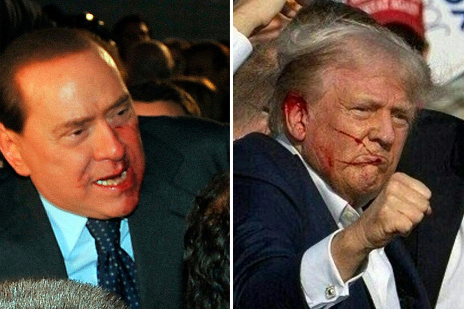 Silvio Berlusconi, colpito al volto con una statuetta nel 2009, e Donald Trump ferito all'orecchio durante un comizio