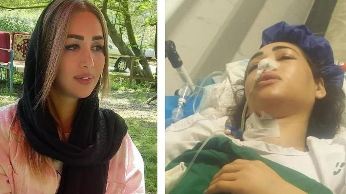 In Iran, la polizia spara su una donna a Noor per non aver rispettato le regole sul velo, lasciandola paralizzata. Un ennesimo episodio di violazioni dei diritti umani.