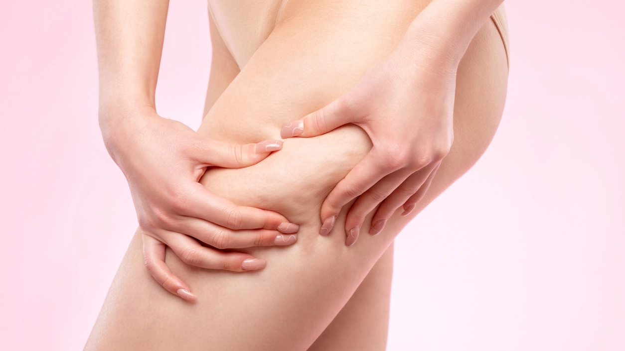 Cellulite - Crediti iStock Photo