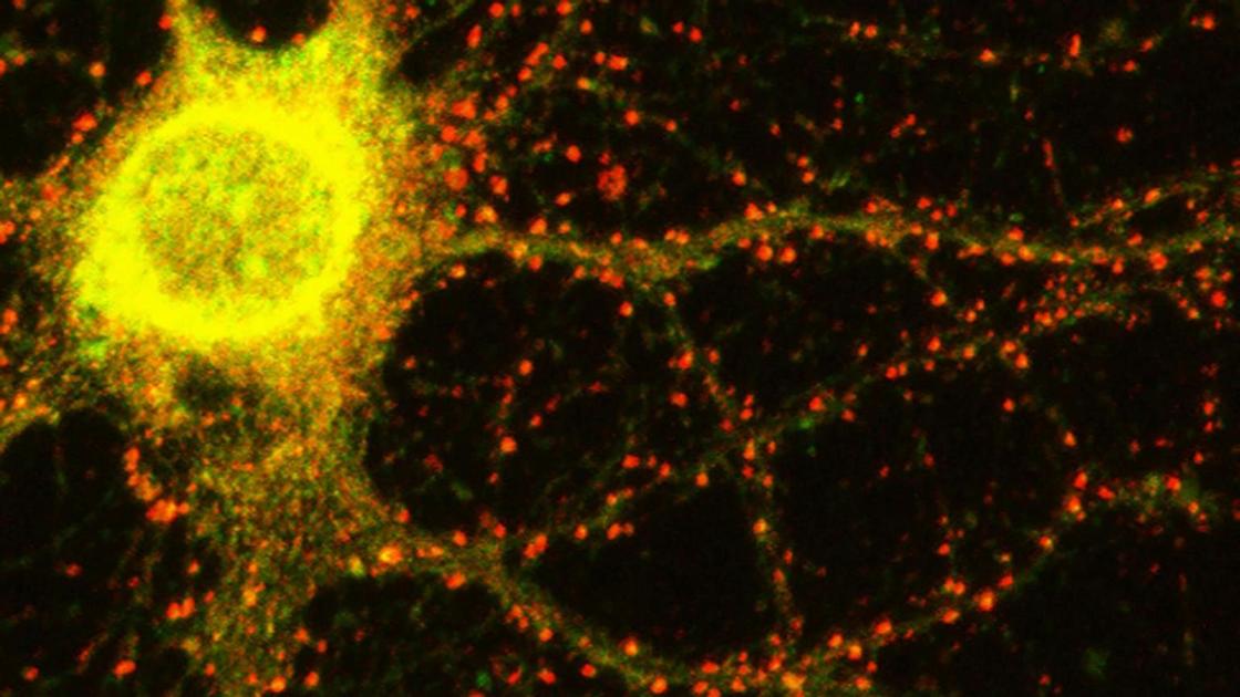 Scoperto il gene Grin2C: nuova causa genetica dell